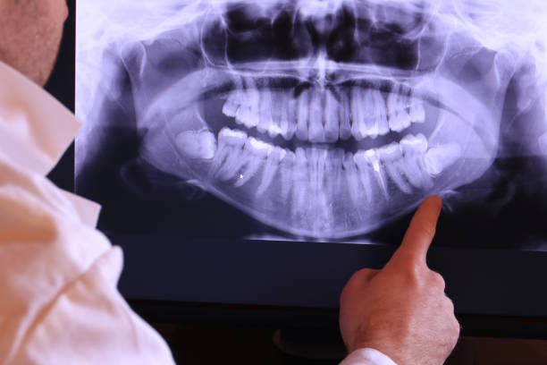 Best Mobile Emergency Dentist in Norwood, NY