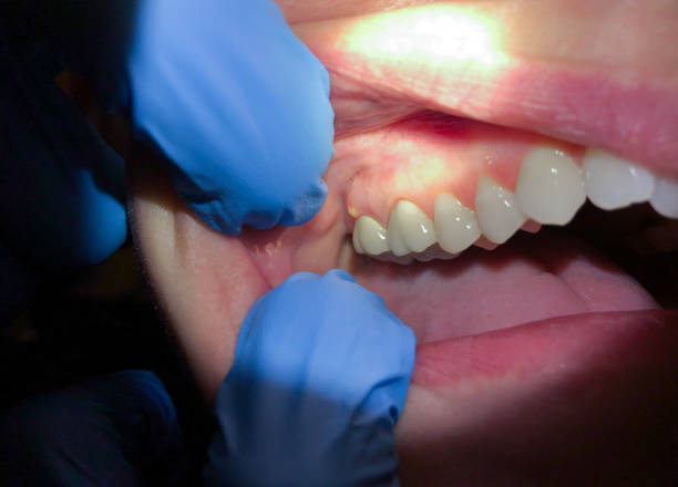 Best Pediatric Emergency Dentist in Norwood, NY